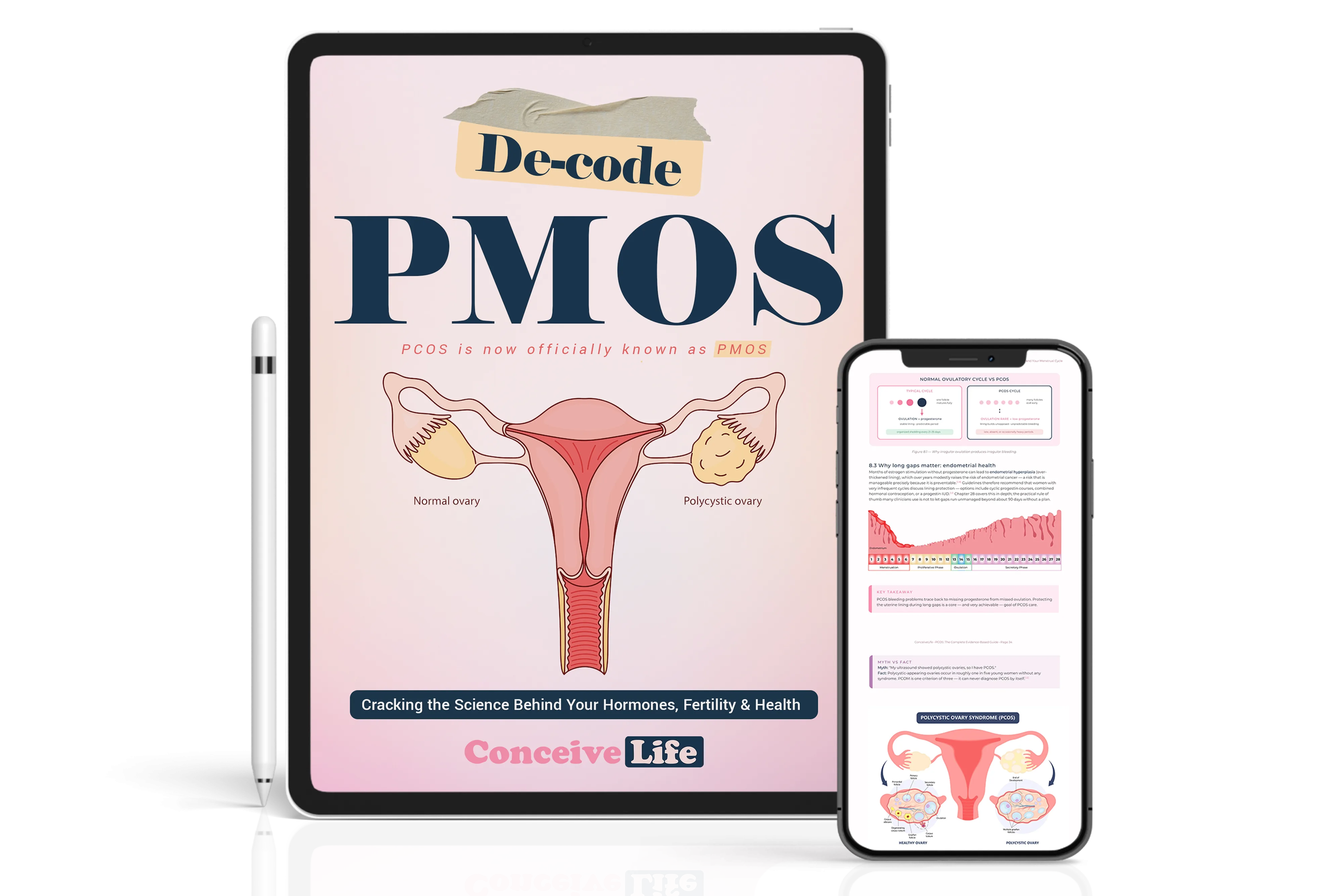 Decode Your PMOS – Conceive Life fertility eBook cover